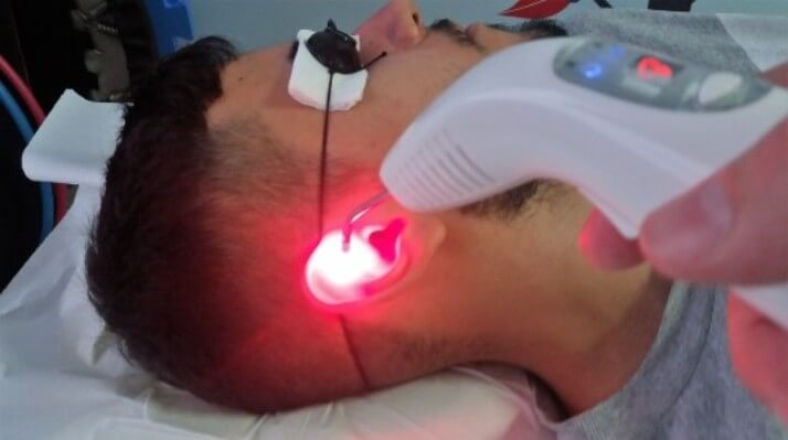 Uso de laser em acupuntura