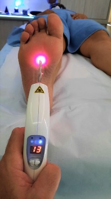 Uso de laser em acupuntura