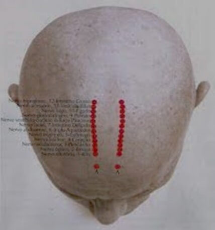 Craniopuntura de Yamamoto - nervos cranianos
