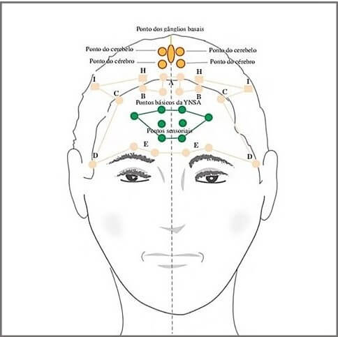 Craniopuntura de Yamamoto - pontos sensoriais