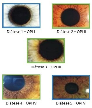 Iridologia - análise da orla pupilar interna