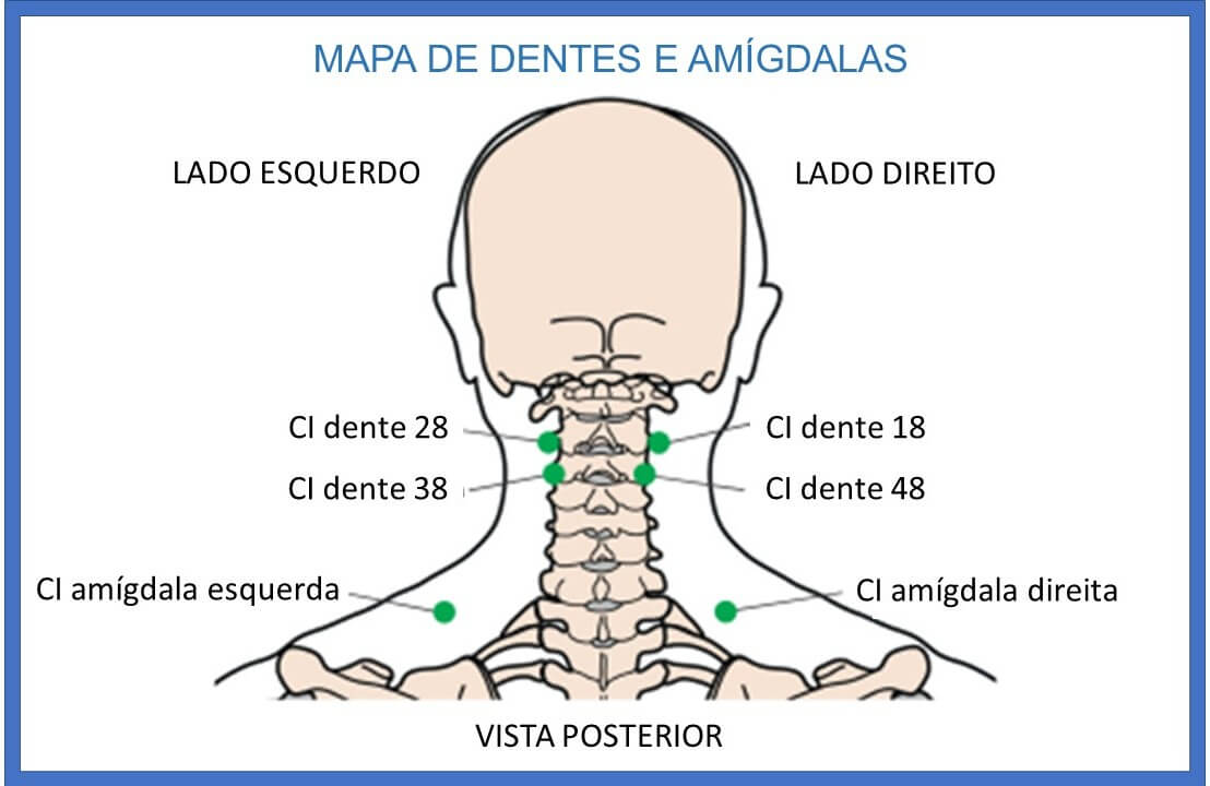 Pontos de acupuntura para dor de cabeça